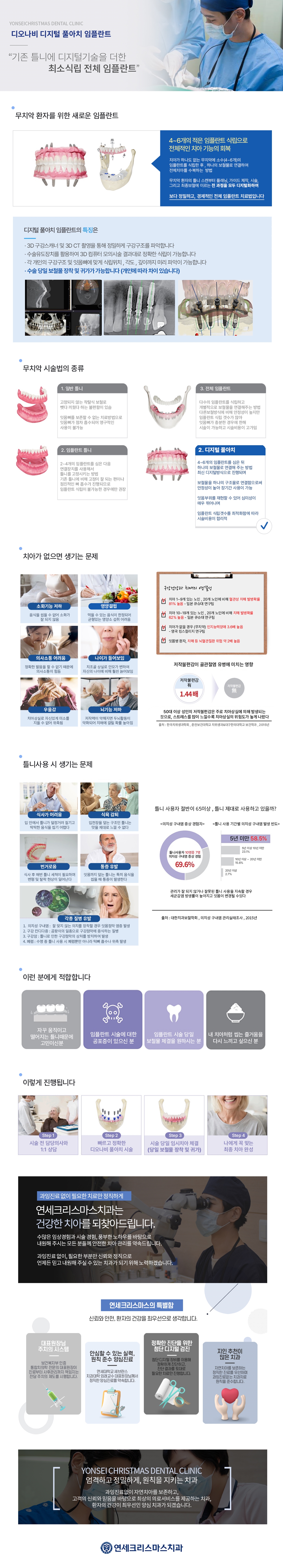 풀아치임플란트